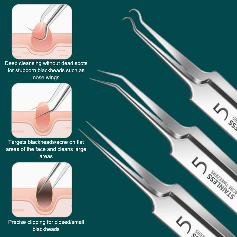 7/8Pcs Blackhead Remover Kit P - огляд і ціна Skincare You